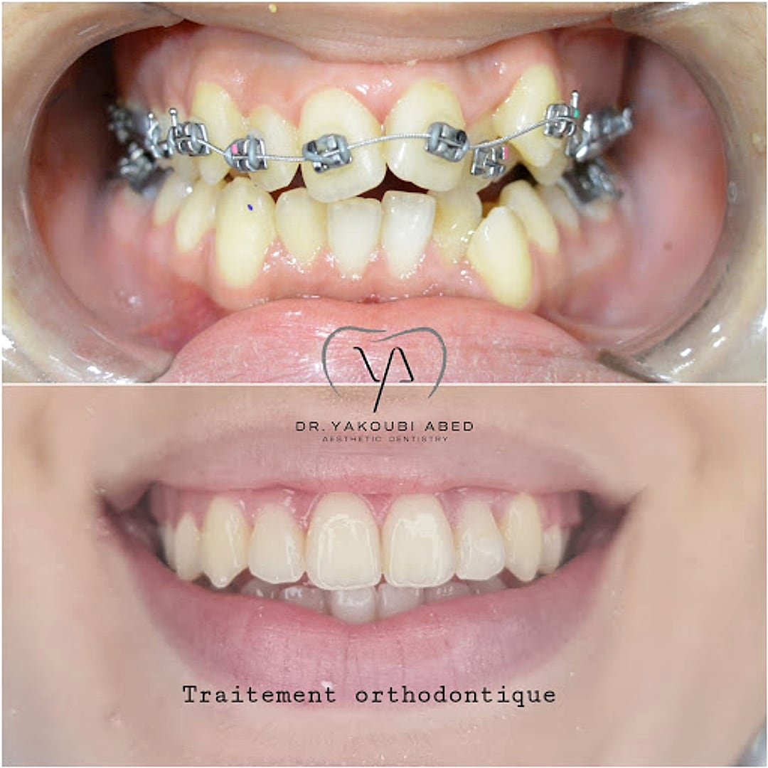 Orthodontie